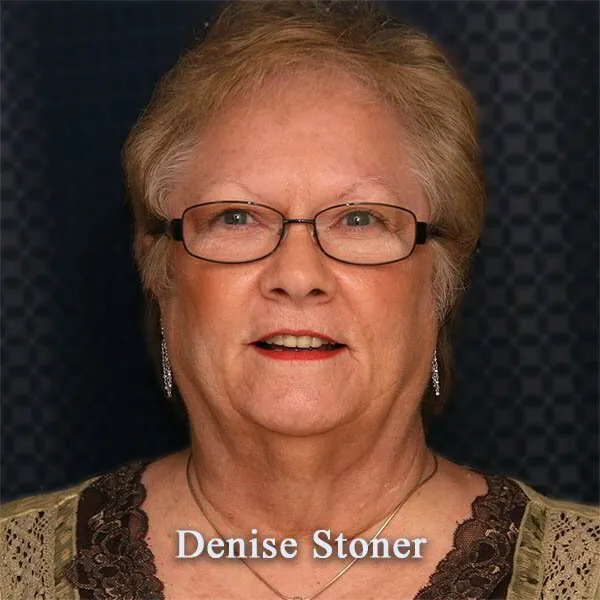 Denise Stoner