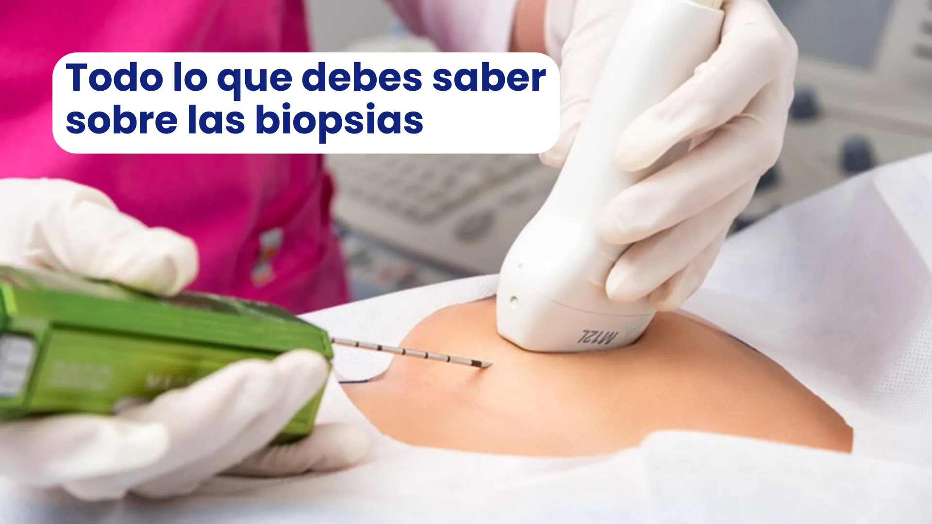 Todo lo que debes saber sobre las biopsias