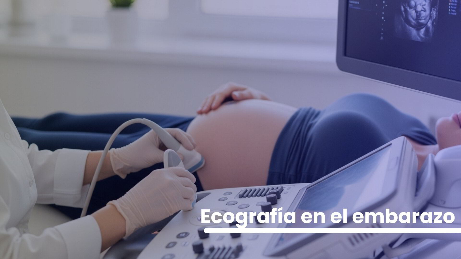 Ecografía en el embarazo: qué revela cada trimestre