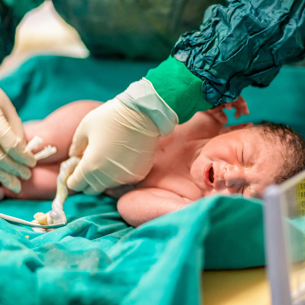 Your Baby’s First Check - APGAR Score