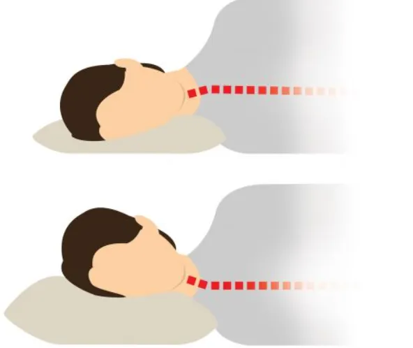 How to Choose a Pillow for Neck Pain - Start Sleeping Better