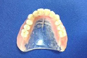 Full Upper Denture with clear palate top view