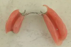 PARTIAL CHROME DENTURE FITTING SURFACE VIEW