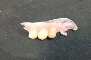 Three-tooth flexible denture Top View