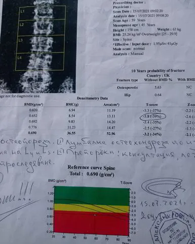 Начално DEXA измерване на Ели