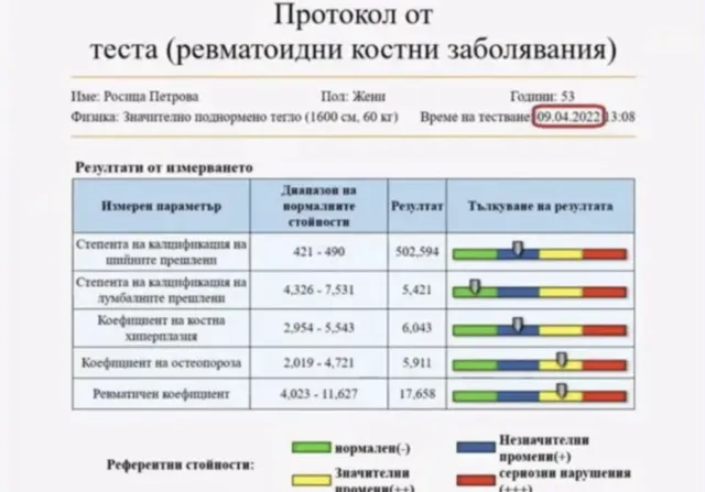 Начално DEXA измерване на Росица