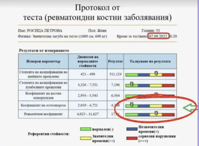 Контролно DEXA измерване на Росица след 5 месеца