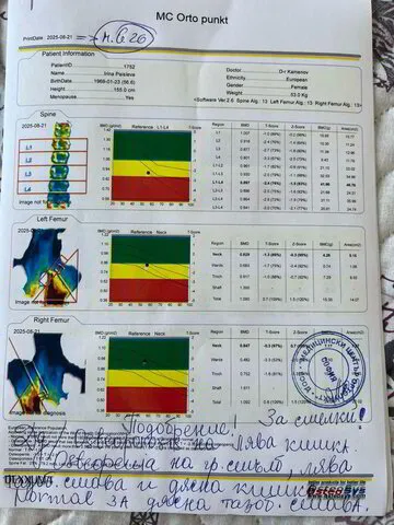 Контролно DEXA измерване на Ирина след 8 месеца