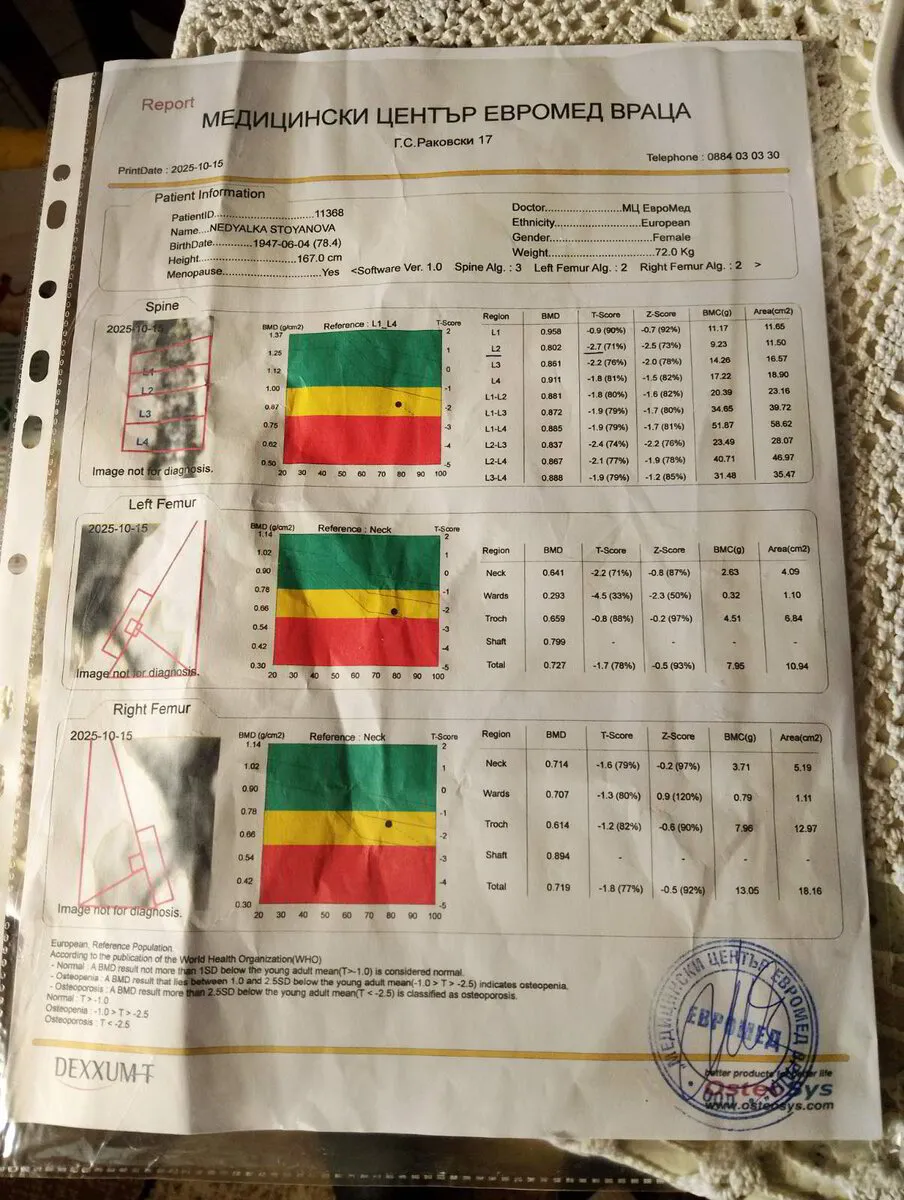 Контролно DEXA измерване на Недялка