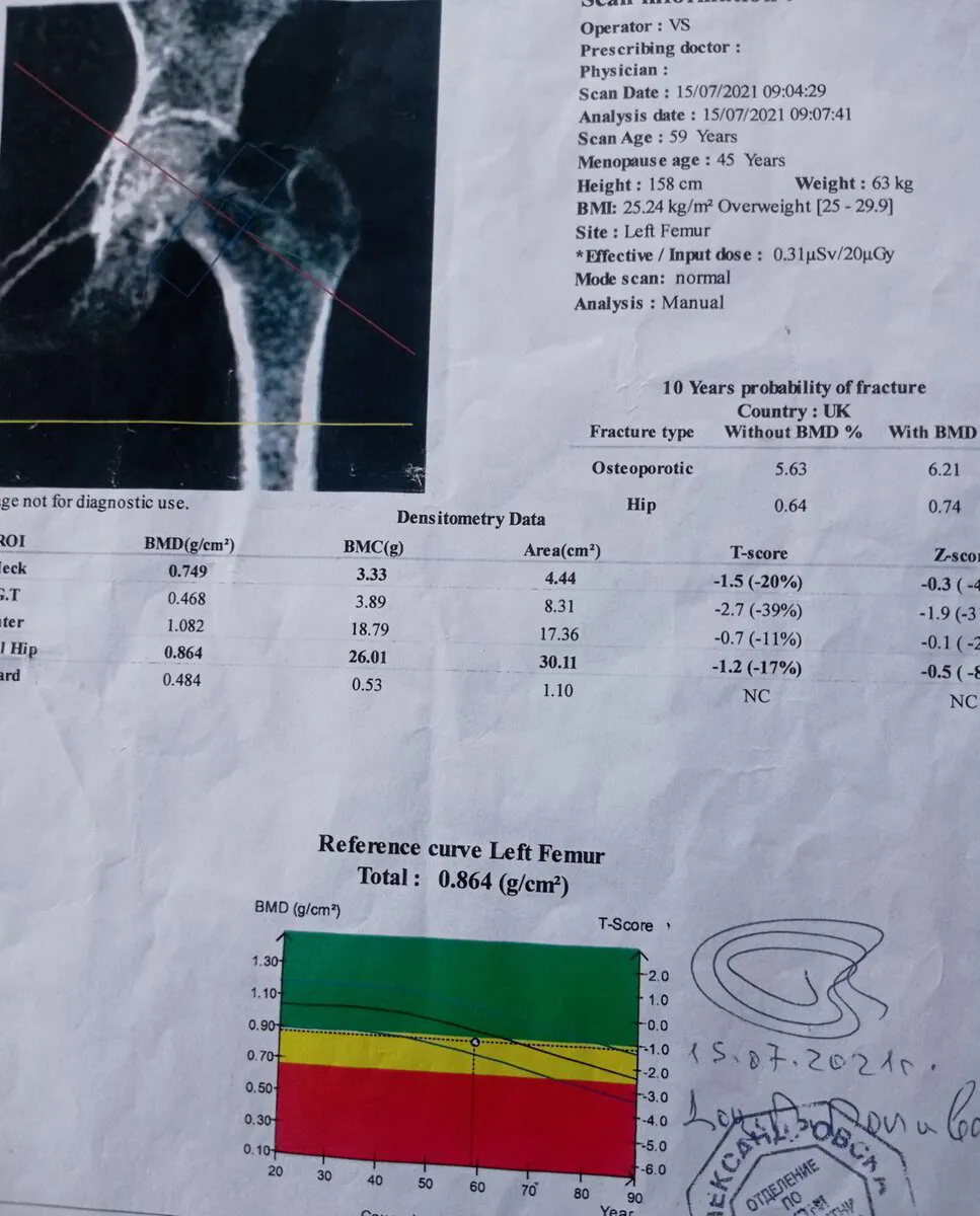 Начално DEXA измерване на Ели — второ