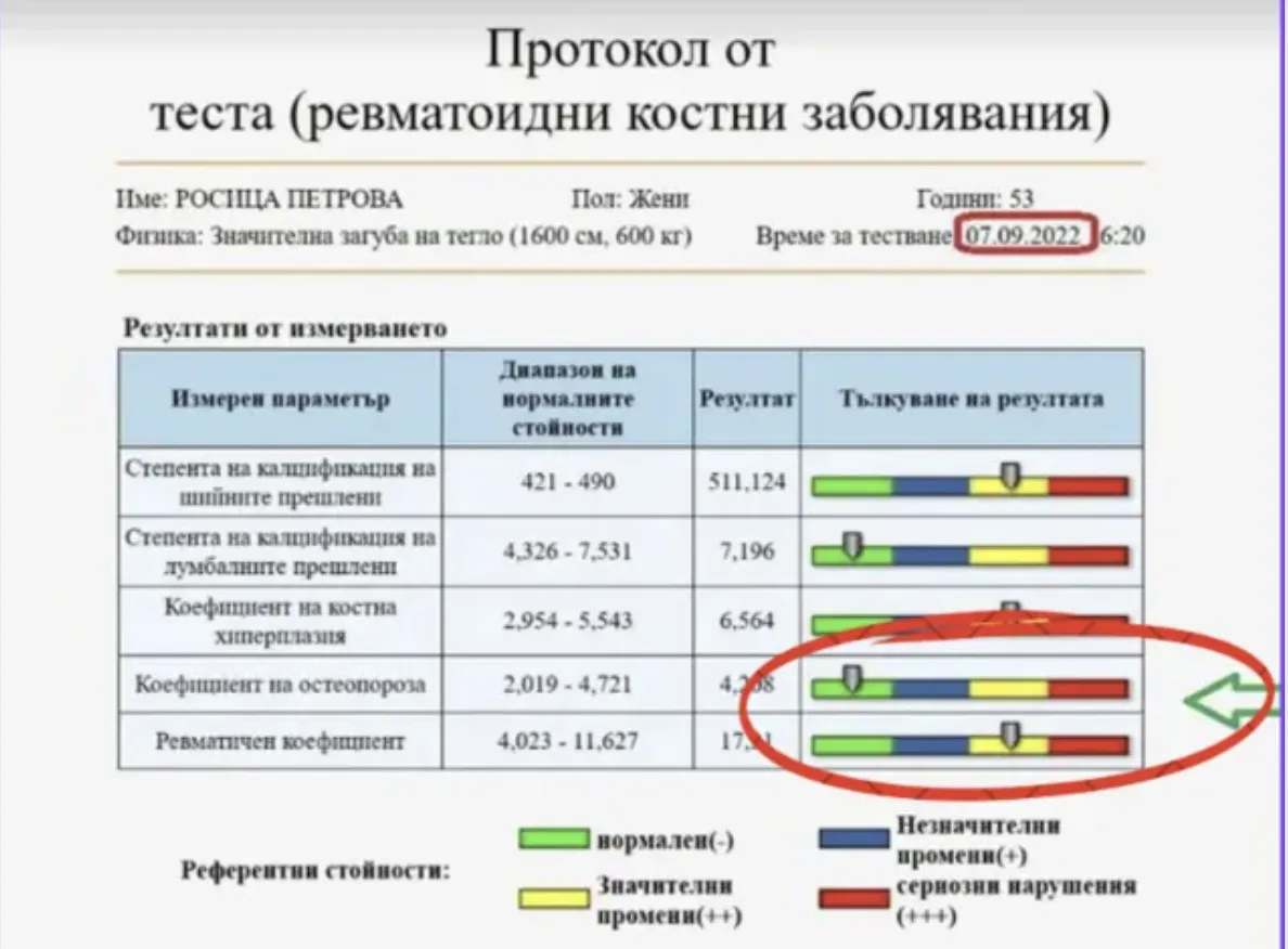Контролно DEXA измерване на Росица след 5 месеца