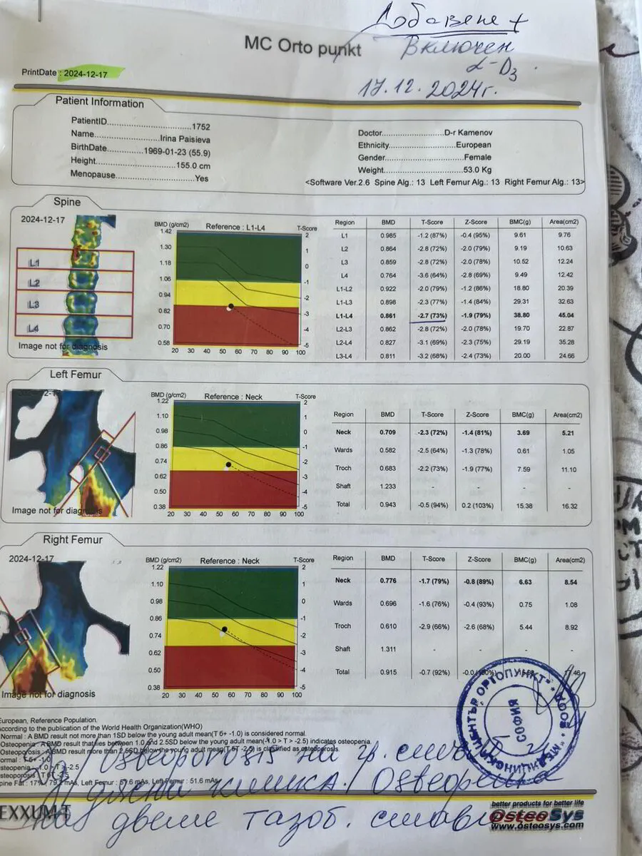 Начално DEXA измерване на Ирина