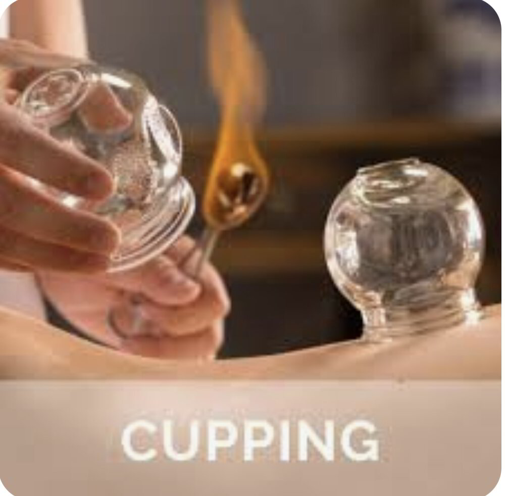 Cupping for muscle pain