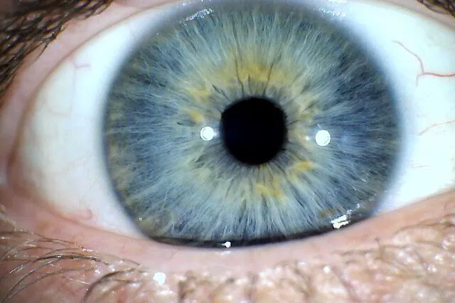 Blue Eye Iridology 