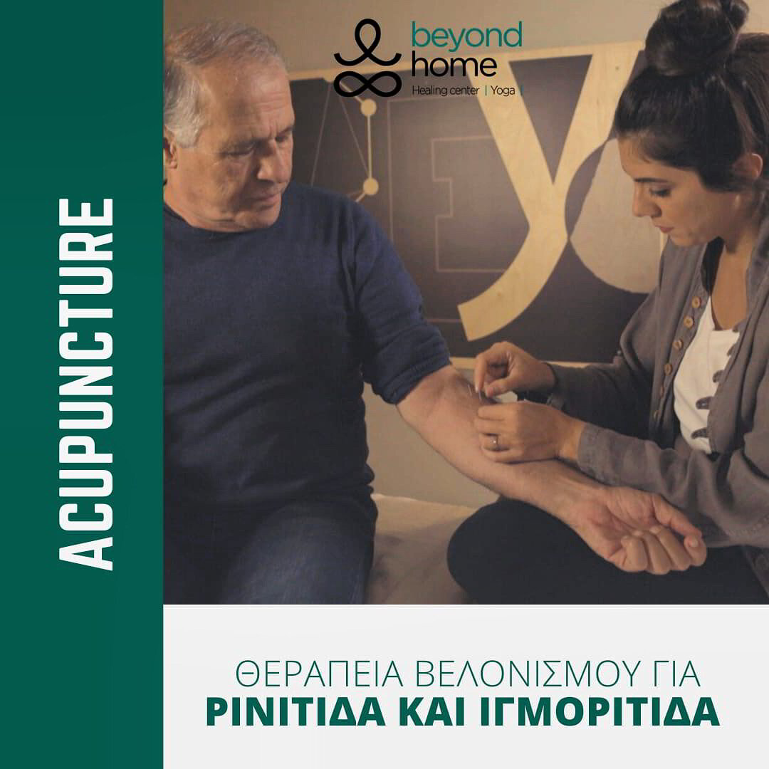 Acupuncture for rhinitis and igmoritis