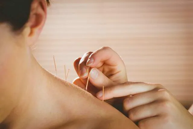 hands placing acupuncture needles in leg