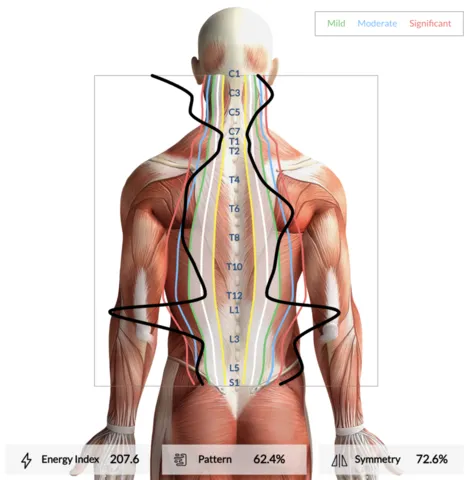 What Are INSiGHT Scans? | Nervous System Scanning at Real Life Health