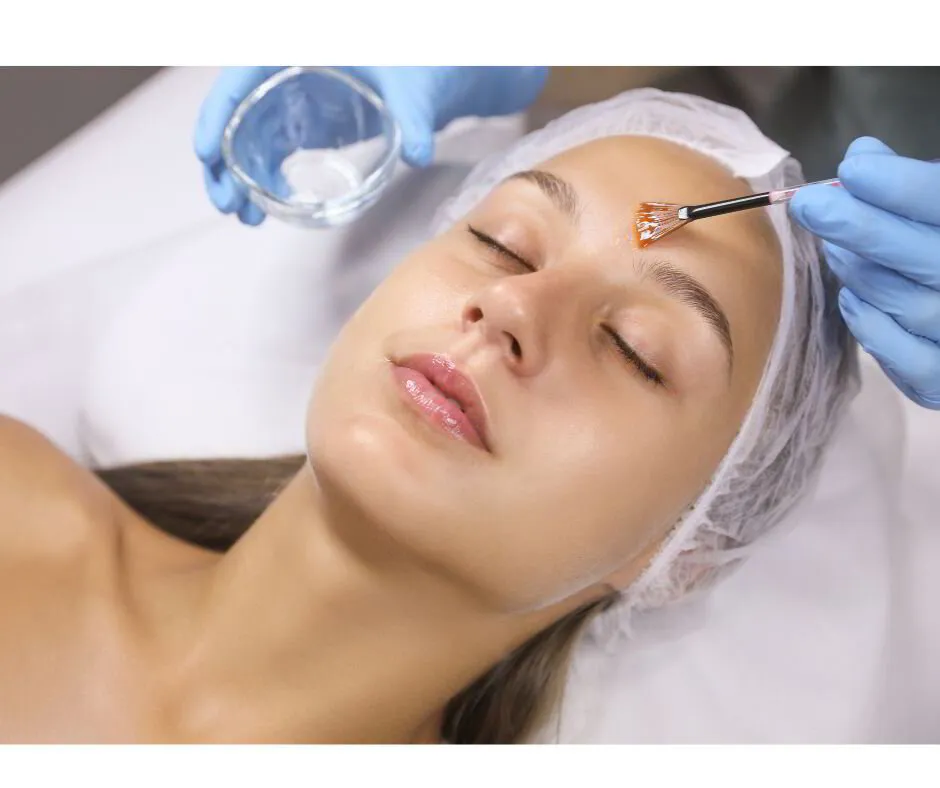 Peeling Químico Facial (45 minutos)