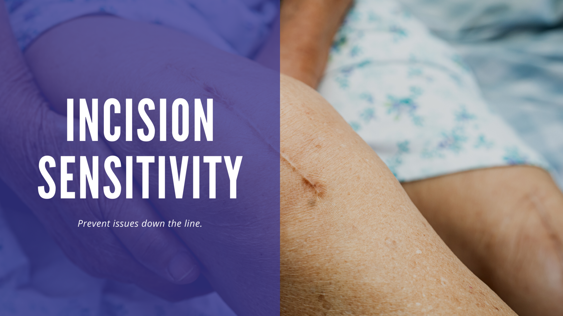 Sentio Incision How do you care for your incision?