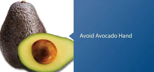 How To Not Go To the Hospital: A Guide To Cutting Avocados