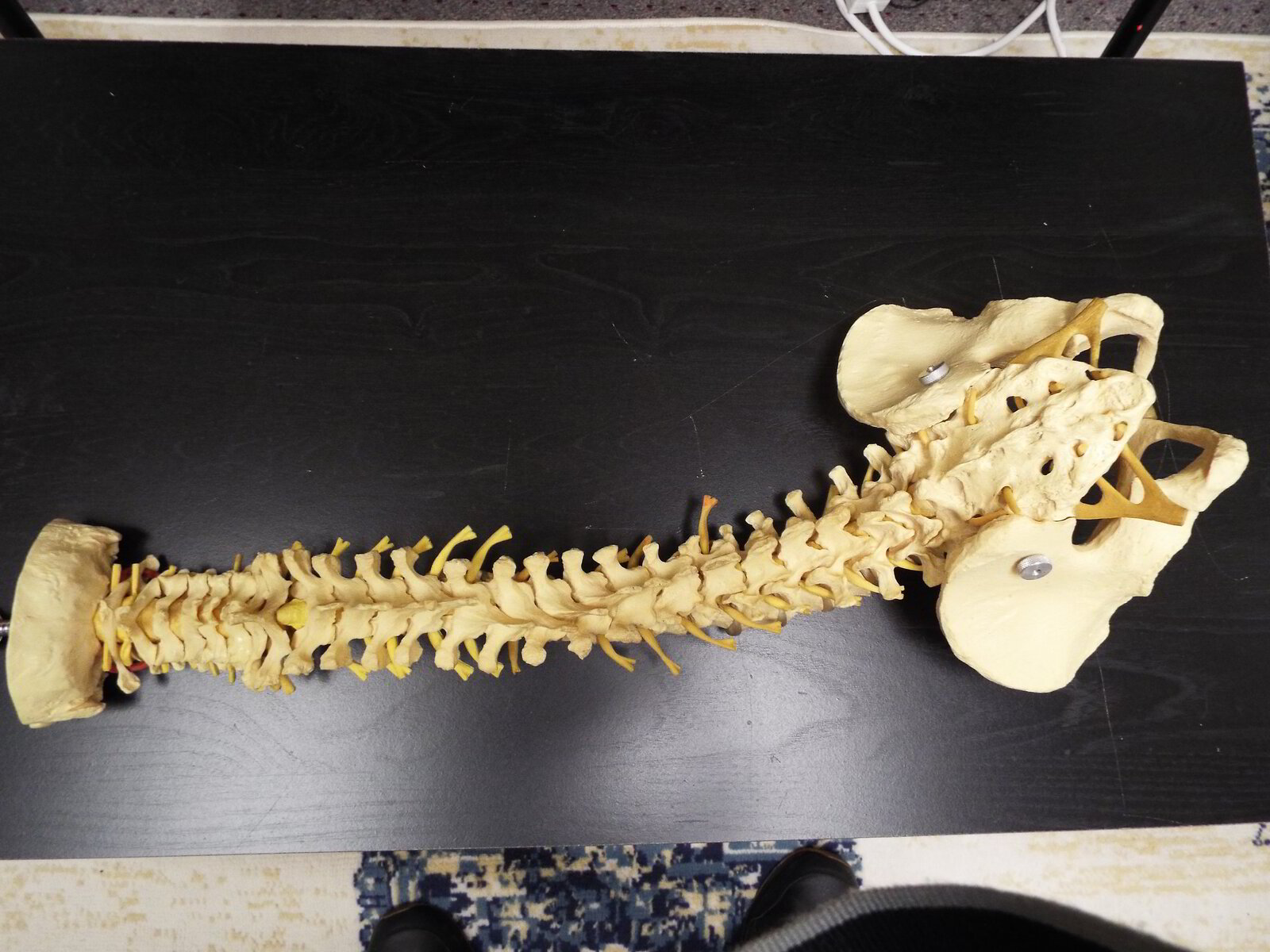 Why Ignoring Postural Pain Can Lead to Long-Term Spinal Issues — A ...