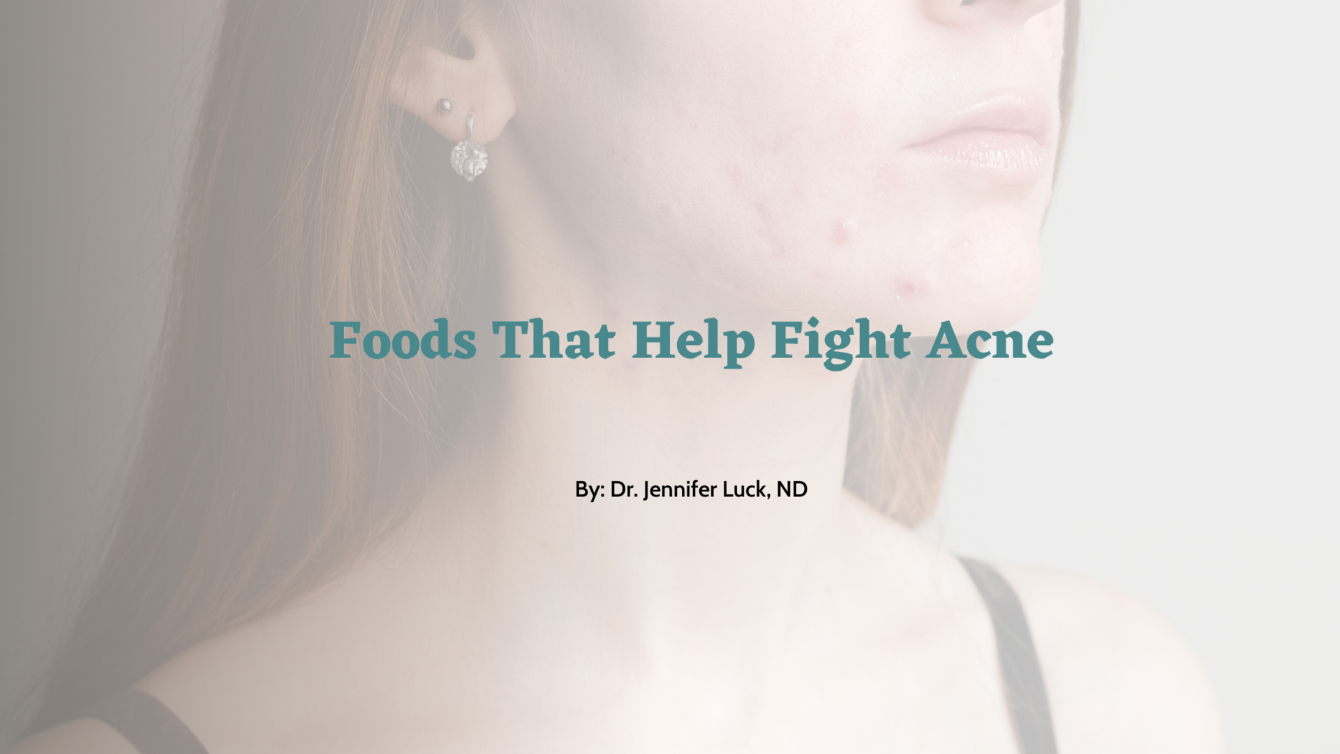 foods-that-help-fight-acne