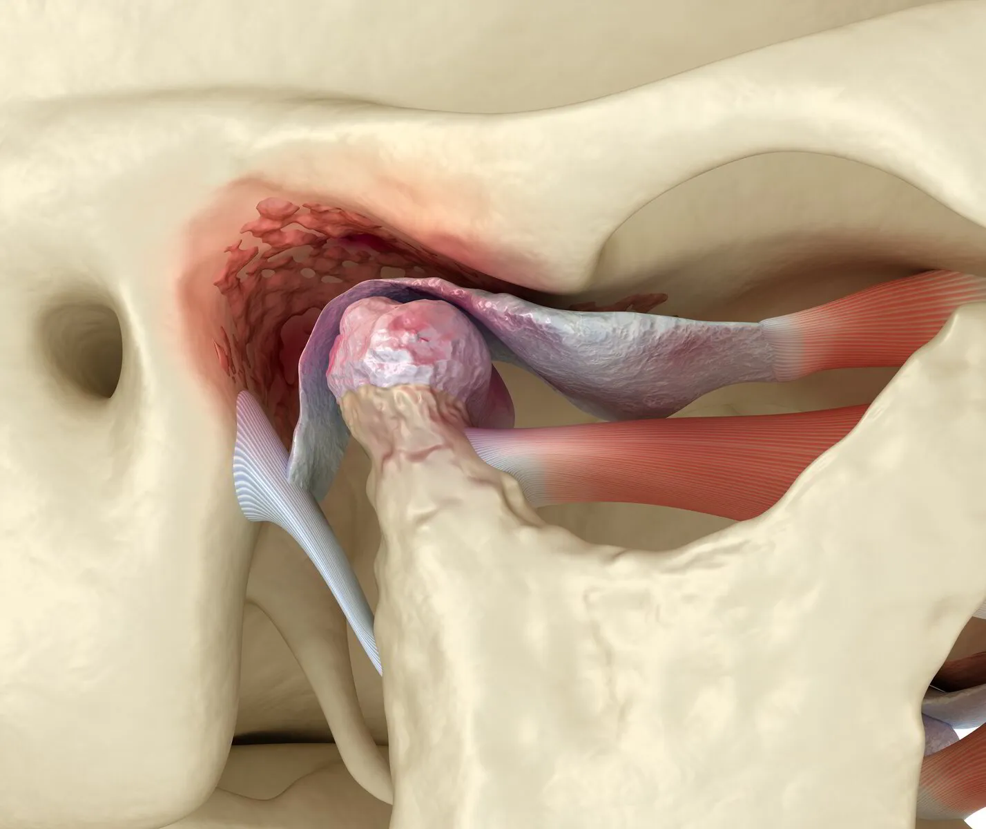 Temporomandibular Joint Dysfunction Webinar - Mobilization and Adjusting