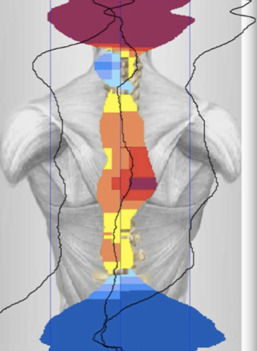 About Dr. Pierce & the Pierce Results System | Chiropractic