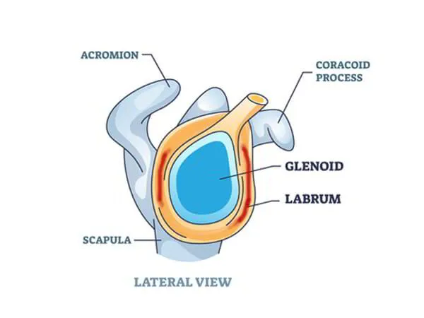 Shoulder Labrum Reconstruction Dr. Pradyumna