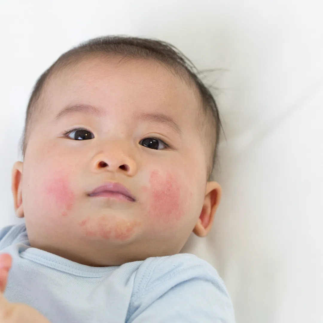 Why is My Child Sick?