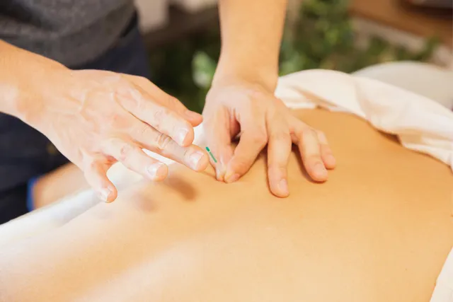 Acupuncturist treating female patient. Practice growth coach Stephanie Palmer helps healthcare providers specialize.