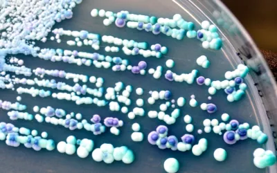 END CANDIDA OVERGROWTH THE NATURAL WAY