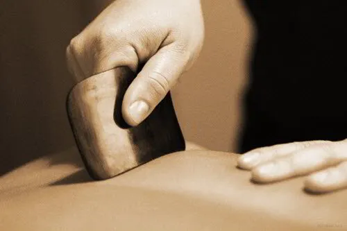 Guasha treatment at Harefield Acupuncture Wantage Oxfordshire