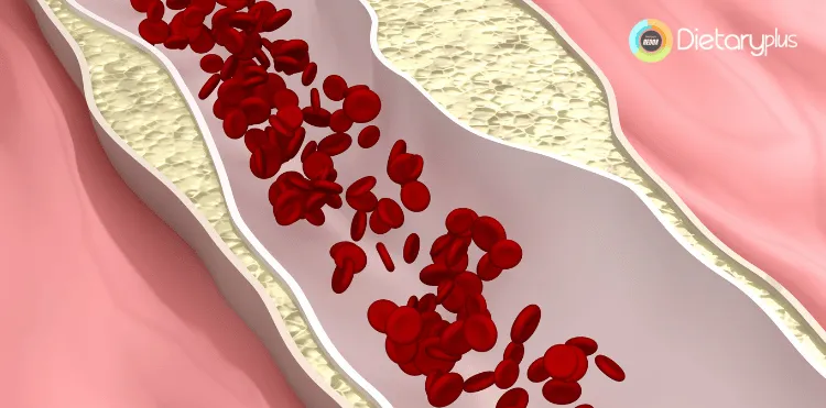 Colesterol y Triglicéridos: Revelamos las Causas Sorprendentes y Cómo Mantener un Corazón Saludable