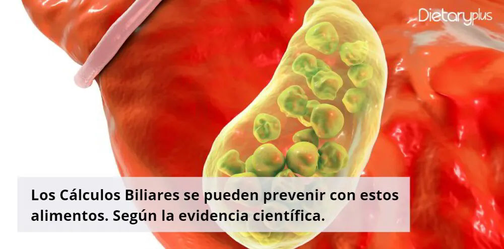 Los Cálculos Biliares se pueden prevenir con estos alimentos. Según la evidencia científica.