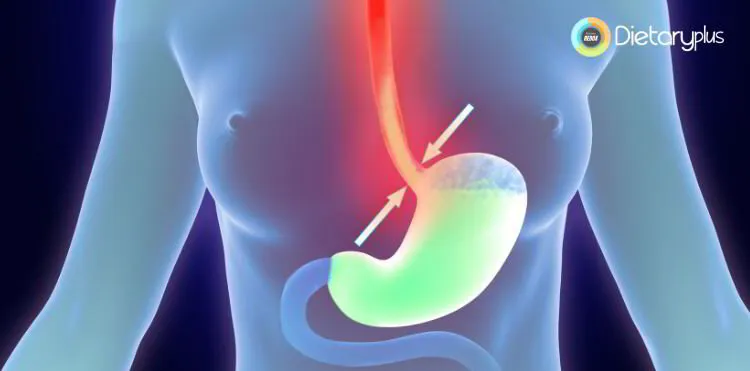 Los tomates pueden empeorar el reflujo ácido y la acidez estomacal