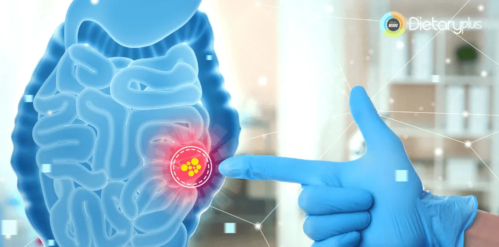 El Papel Fundamental de las Fibras Dietéticas en una Alimentación Equilibrada