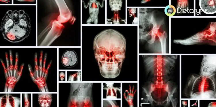 Potenciales riesgos de los tomates
