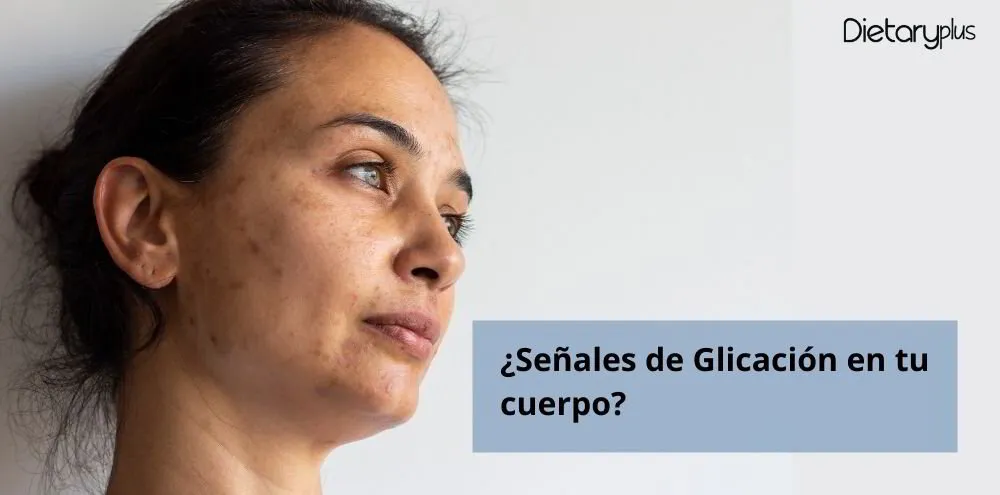 Nutricionistas de Zaragoza te muestran las señales de Glicación en tu cuerpo.