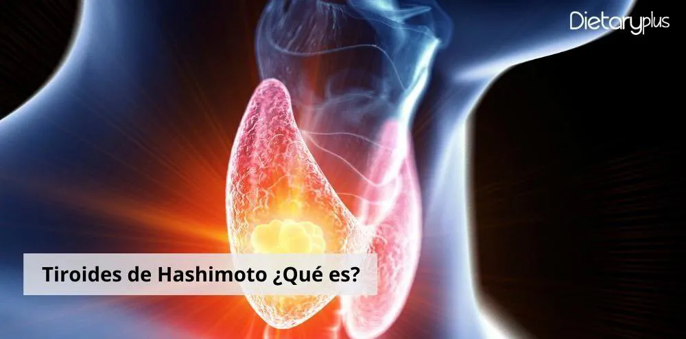 Tiroides de Hashimoto ¿Qué es?