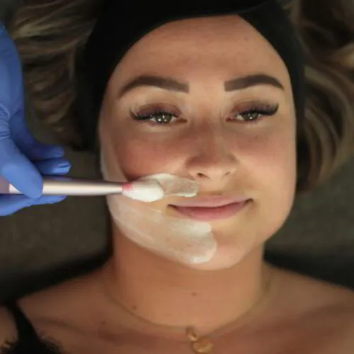 Microneedling bei KEMPHA® in Wiesbaden