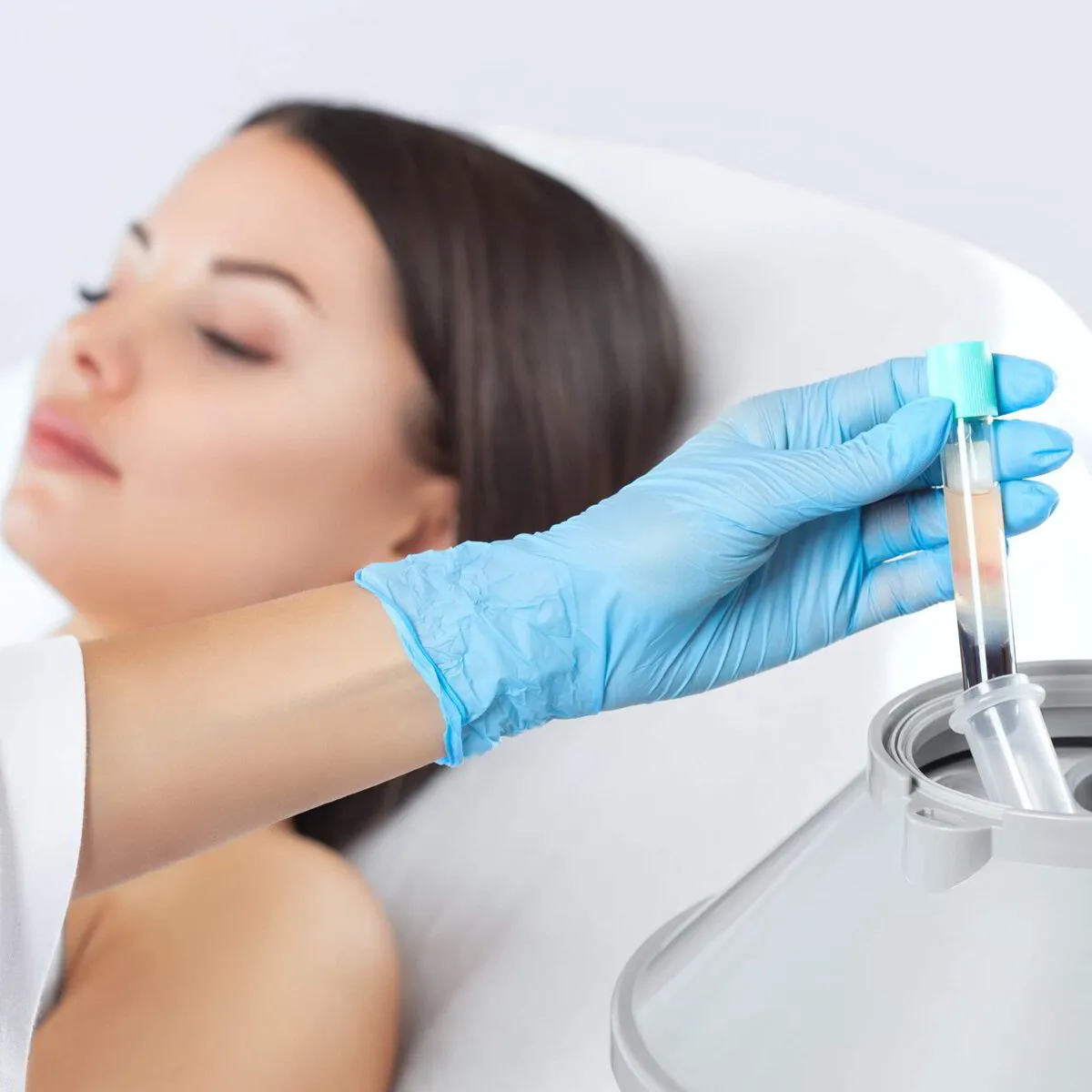How long do PRP facial injections last?