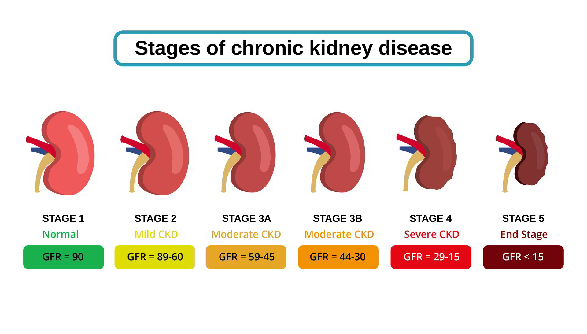 What is the Kidney Trap, and How do we avoid it?