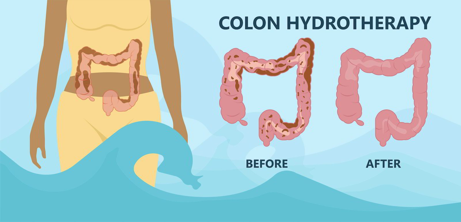 colon hydrotherapy waste