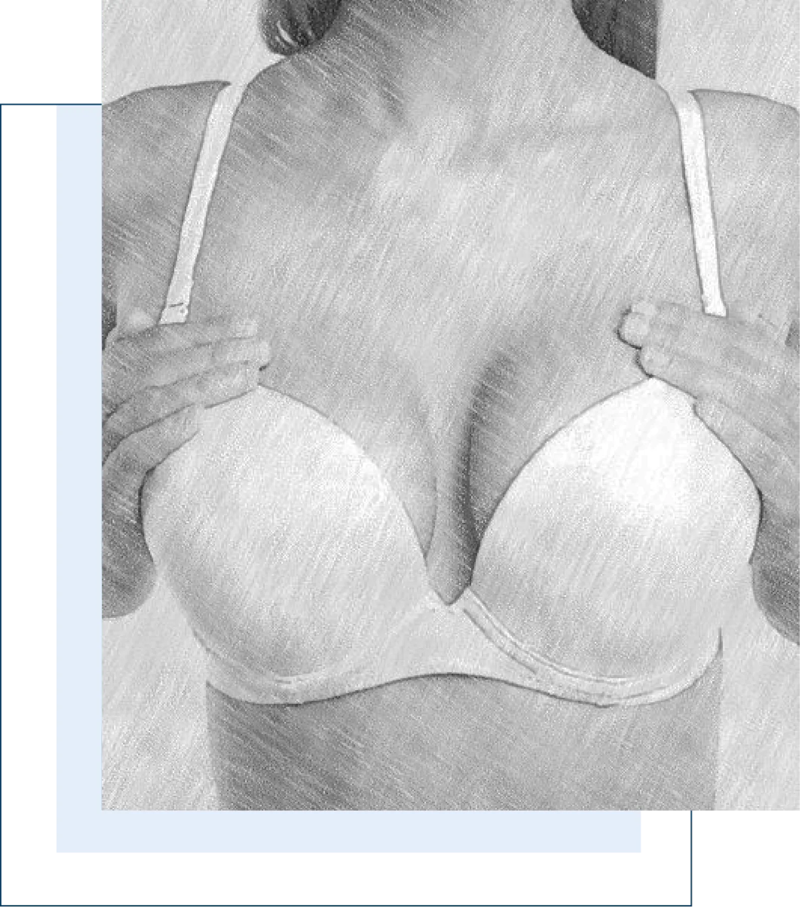Breast lift Surgery
