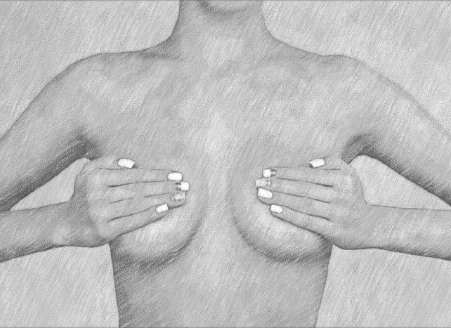Breast Correction: The Waterfall Deformity