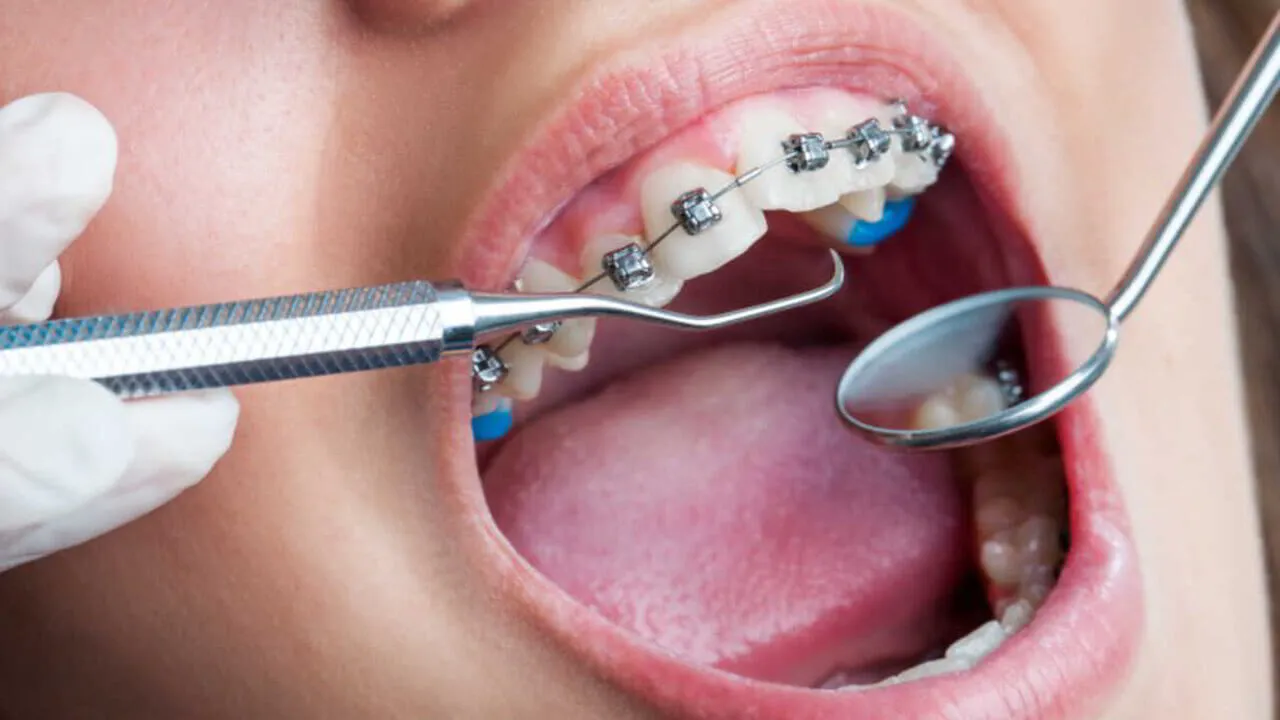 What Is Orthodontic Treatment, And Is It Available In Victoria?