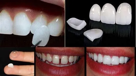 Imagen Dental Avanzada Atizapan