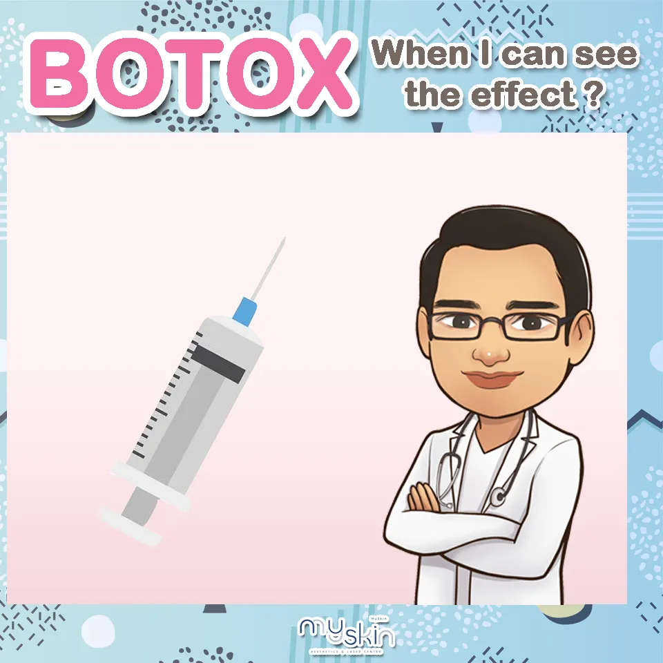 Botox Injection, When can I see its effect ? 