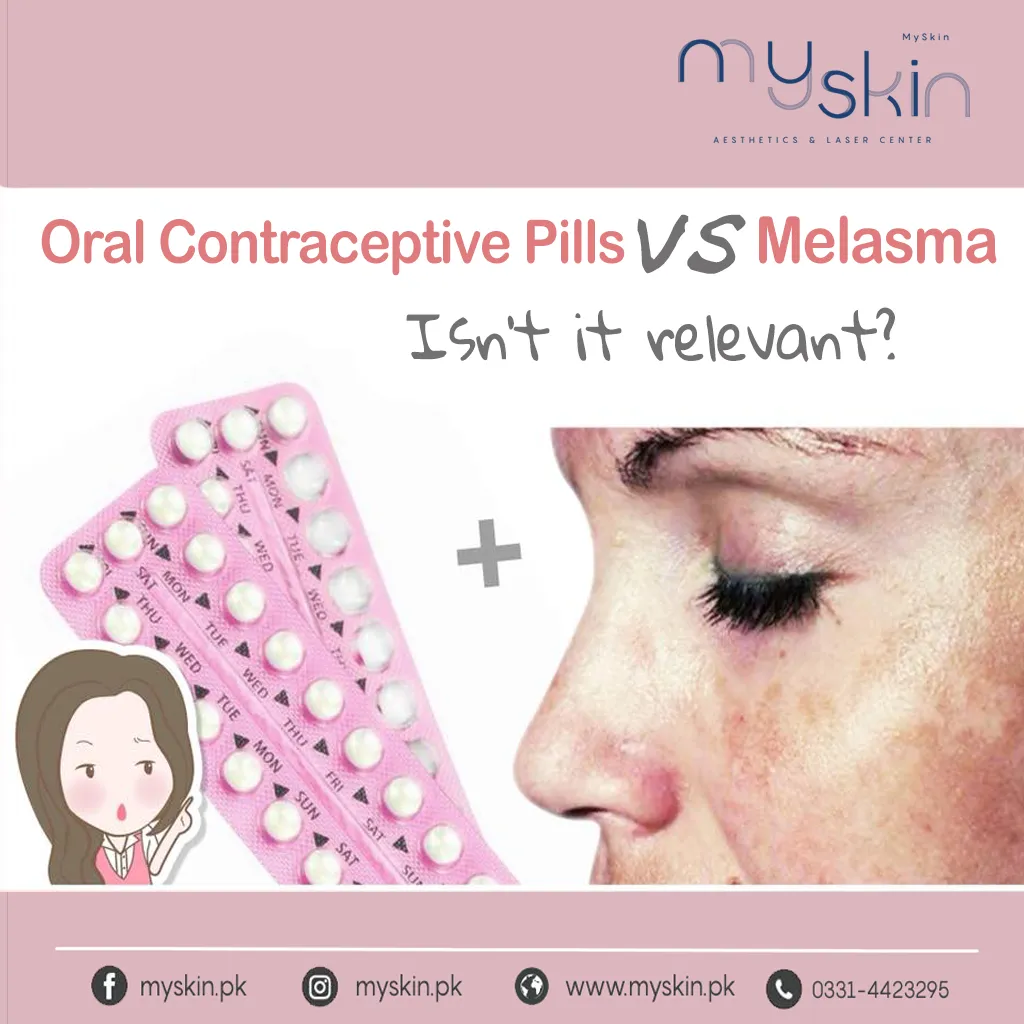 Stop Oral Contraceptive Pill to get rid of your Melasma